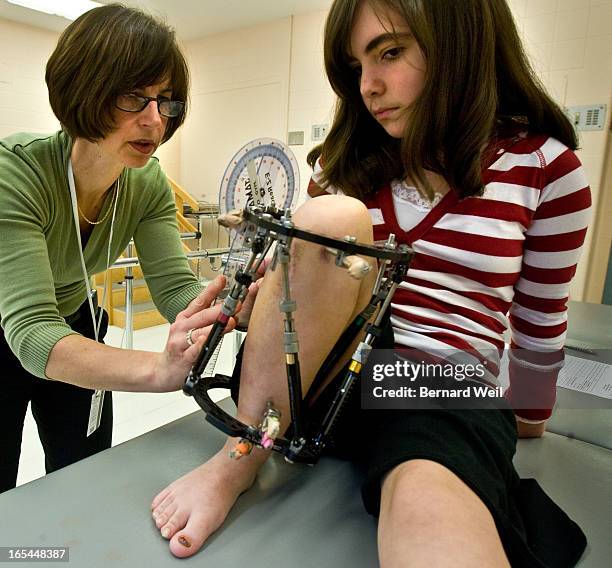 BW_SickKids_Jenna2 022508 FOR SICK KIDS SPECIAL SECTION Physiotherapist Rita Damignani takes measurements of 14-year-old Jenna Shea's right leg,...