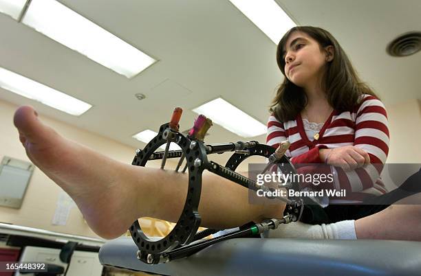 BW_SickKids_Jenna4 022508 FOR SICK KIDS SPECIAL SECTION Jenna Shea undergoes physiotherapy, February 25 at Toronto's Hospital for Sick Children. Shea...