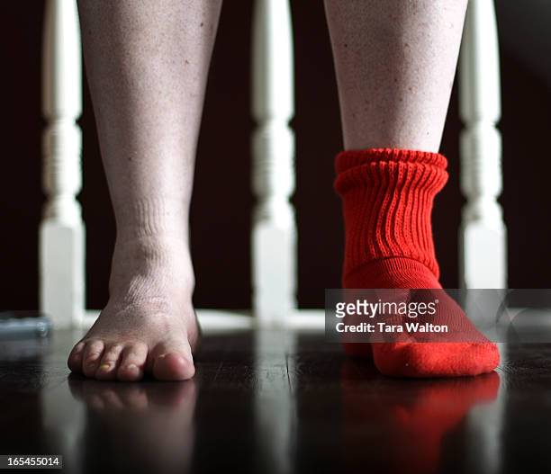 May 20, 2010-ORPHANED SOCK-James Woollatt wears his orphaned red-orange sock Thursday May 20, 2010. The Sock was orphaned about a year ago after a...
