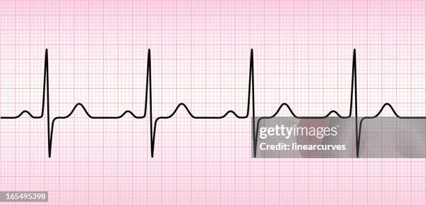 ecg wave - electrocardiography 幅插畫檔、美工圖案、卡通及圖標