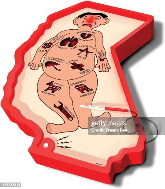 Parra color illustration of Operation game in the shape of California with an expired patient whose wounds expose factors that caused the death of...