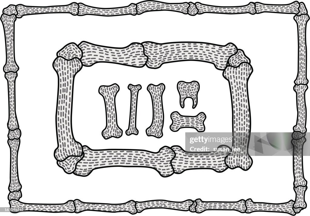 Bone frames