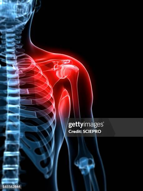 shoulder pain, conceptual artwork - shoulder pain stock illustrations