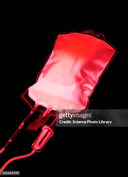 blood bag - blood bag stock pictures, royalty-free photos & images