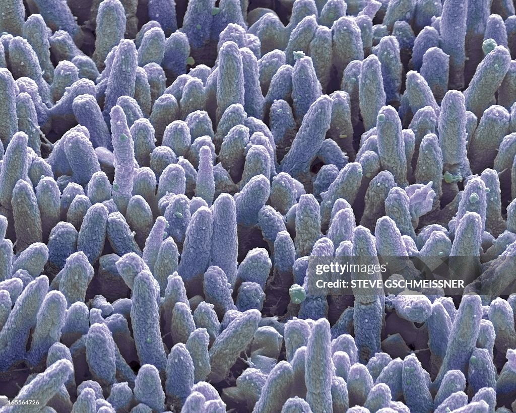 Dental plaque, SEM