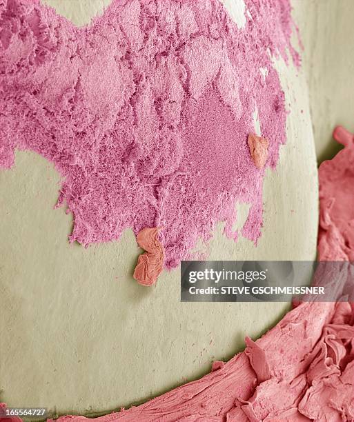 dental plaque, sem - plaque bacteria fotografías e imágenes de stock