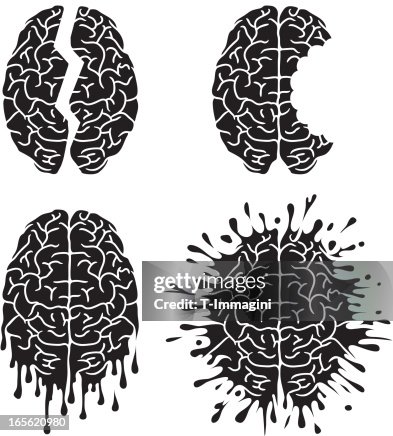 Brain damage Brain damage