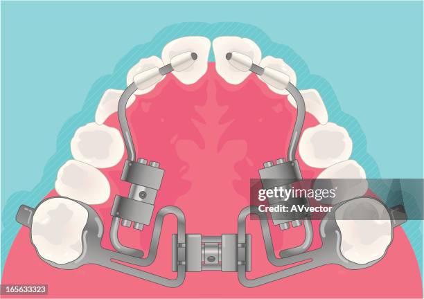 orthodontic - kieferorthopäde stock-grafiken, -clipart, -cartoons und -symbole