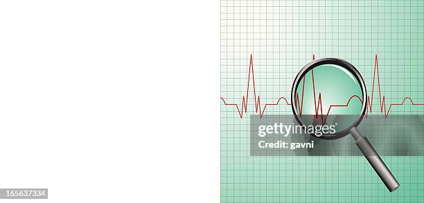 ecg - the unexpected stock illustrations