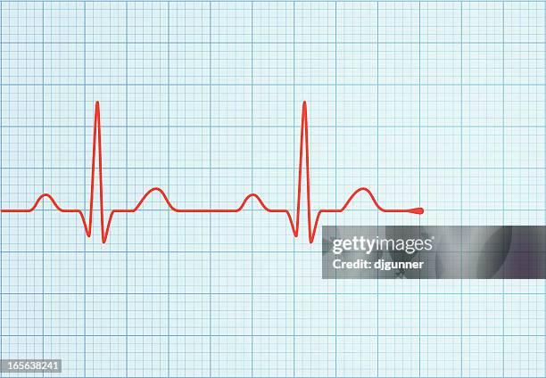 vektor ecg trace - pulsmessung stock-grafiken, -clipart, -cartoons und -symbole