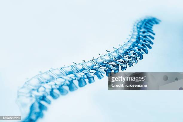 human spine - orthopaedic equipment stock illustrations