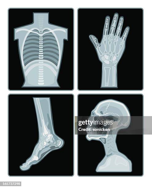 stockillustraties, clipart, cartoons en iconen met x-ray films collection - menselijk been