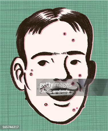 RETRO SKIN PROBLEMS RETRO SKIN PROBLEMS