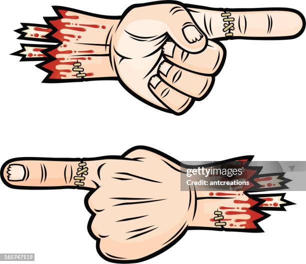 Injured Hand Cartoon High Res Illustrations - Getty Images Injured Hand Cartoon High Res Illustrations - Getty Images