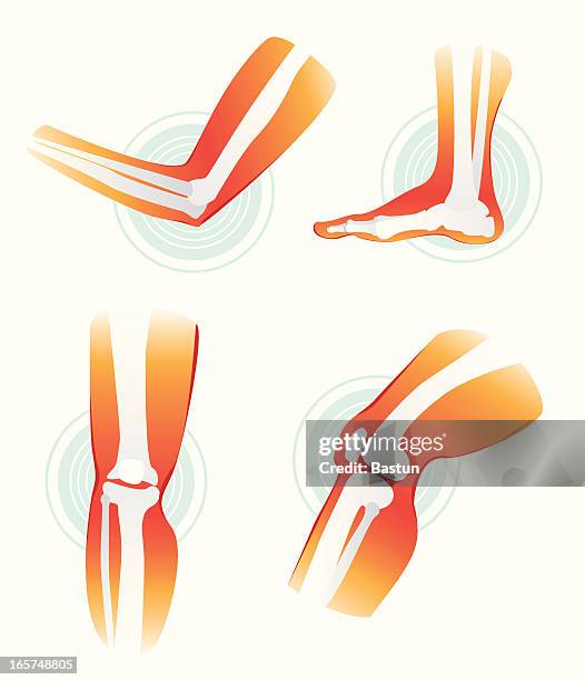 schmerzen in gelenke - osteoporose stock-grafiken, -clipart, -cartoons und -symbole