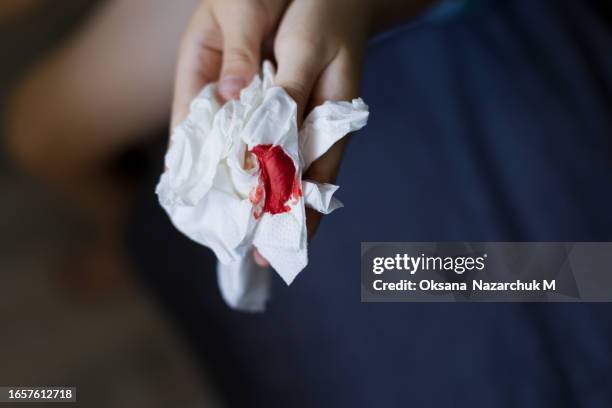 nosebleed ,schoolboy holds tissue with blood - nose bleed stock pictures, royalty-free photos & images