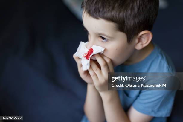 nosebleed ,schoolboy suffering from nose bleeding - nose bleed stock pictures, royalty-free photos & images