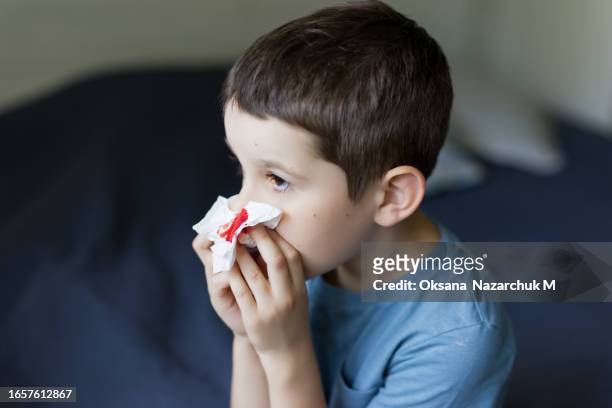 nosebleed ,schoolboy suffering from nose bleeding - chronic wound stock pictures, royalty-free photos & images