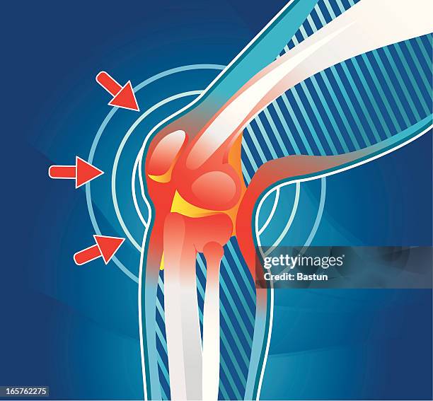 pain in joint - sprain stock illustrations