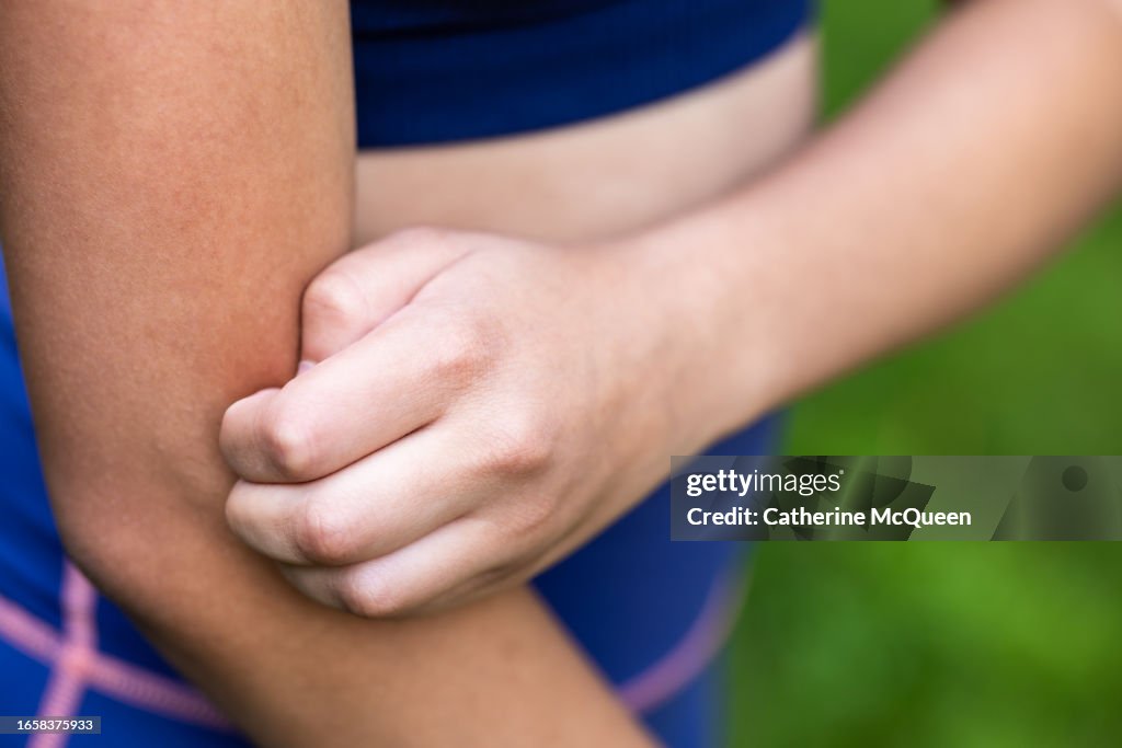 Young multiracial woman scratches arm after insect bite