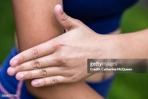 young multiracial woman hits mosquito on her arm - west nile virus ストックフォトと画像