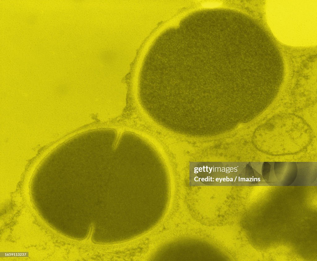 Staphylococcus aureus was cultured in the medium and photographed at 80,000 times magnification with a transmission electron microscope. Taken during cell division