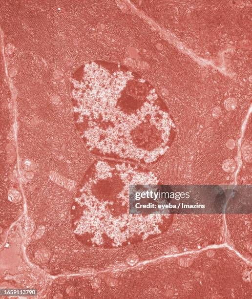 pancreatic tissue was photographed with a transmission electron microscope - menschliches gewebe stock-fotos und bilder