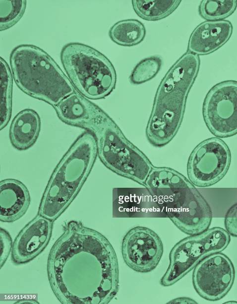 pathogenic yeast (candida tropicalis) was cultured in the medium and psudohyphae were photographed with a transmission electron microscope - célula cultivada fotografías e imágenes de stock