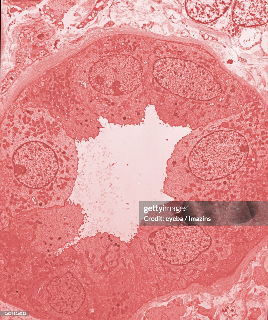 A transverse section of the renal tubule was taken by transmission electron microscopy