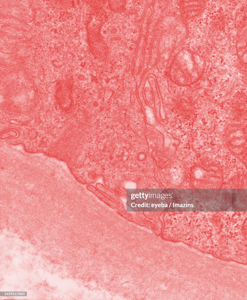 A transverse section of the renal tubule was taken by transmission electron microscopy
