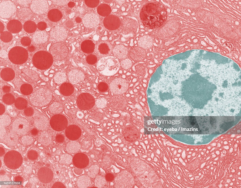 Pancreatic tissue was photographed with a transmission electron microscope