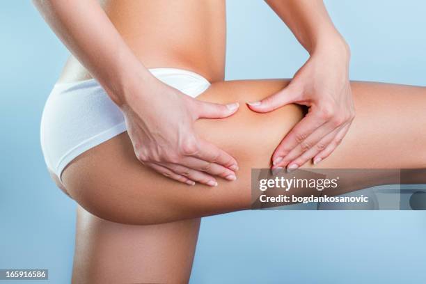 cellulitis - cellulite stock pictures, royalty-free photos & images