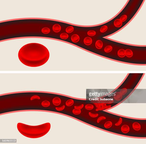 human blood cells and sickle cell anemia blood flow veins - anaemia stock illustrations