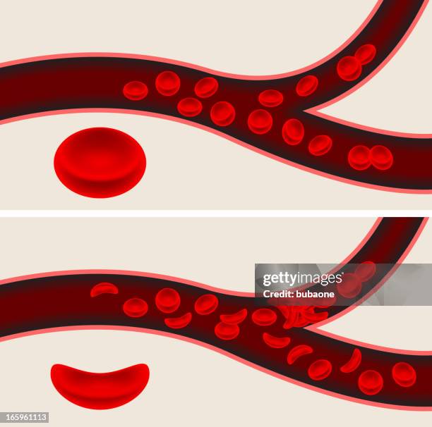 human blood cells and sickle cell anemia blood flow veins - blood cell formation stock illustrations