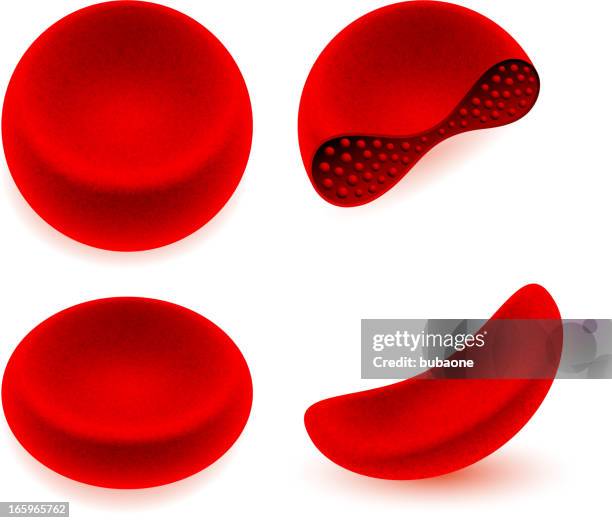 664点の鎌状赤血球貧血のストックフォト Getty Images 664点の鎌状赤血球貧血のストックフォト Getty Images