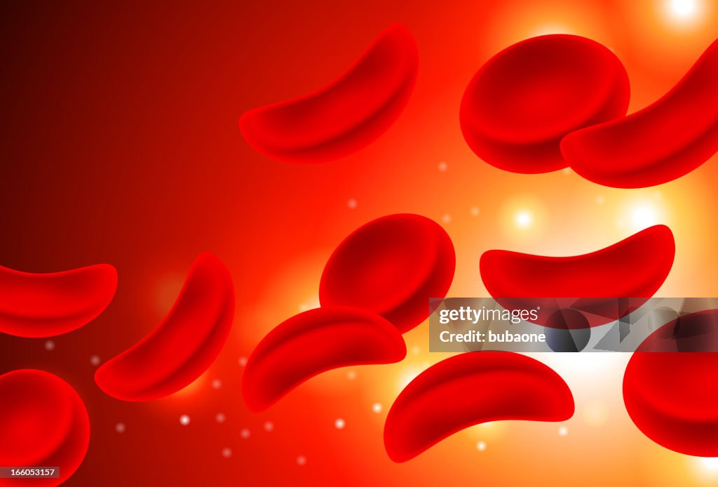 Sickle Cell Anemia Red cells in Blood Stream