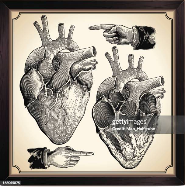 stockillustraties, clipart, cartoons en iconen met human heart - angina