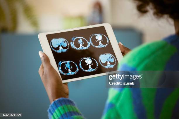 woman analyzing mri scans on digital tablet - medical x ray stock pictures, royalty-free photos & images