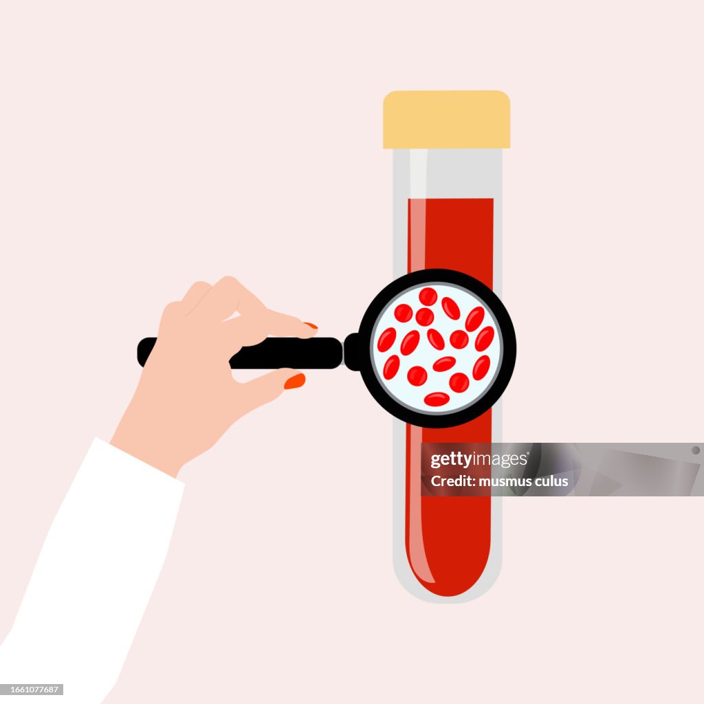 Blood Sample Lab Graphics Blood Laboratory High-Res Vector Graphic - Getty Images