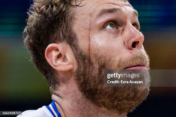 Scratch is seen on the face of Nicolo Melli of Italy during the FIBA Basketball World Cup quarter final game between Italy and USA at Mall of Asia...