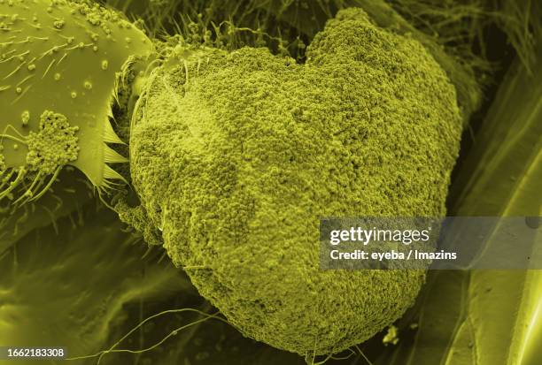 Pollen Microscope Images 67 Pollen Scanning Electron Microscope Stock Photos, High-Res Pictures ...
