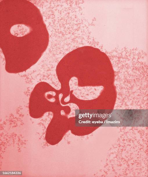 Imtamure Rbc Immature Red Blood Cell Photos and Premium High Res Pictures - Getty Images