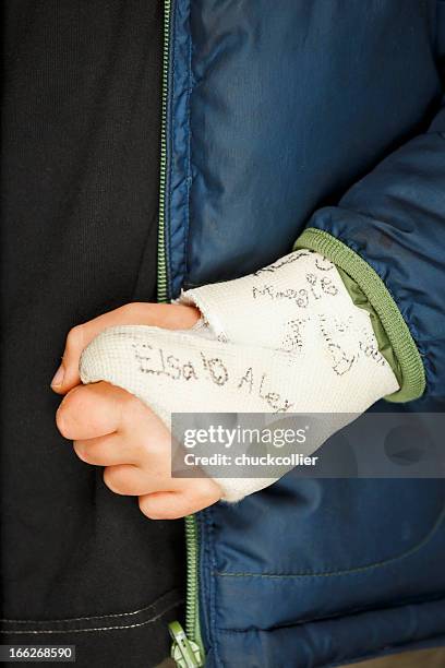 Hand In Cast 6,823 Hand In Cast Stock Photos, High-Res Pictures, and Images - Getty ...