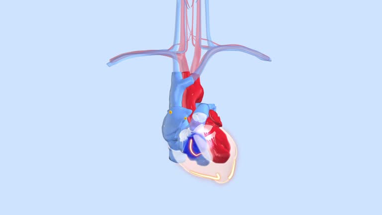 Pacemaker Annimation 63 Pacemaker Syndrome Stock Videos, Footage, & 4K Video Clips - Getty ...