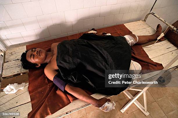 Man who has lost his leg after stepping on a landmine lies critically injured on a bed in a small clinic. Doctors have done what they can but there...