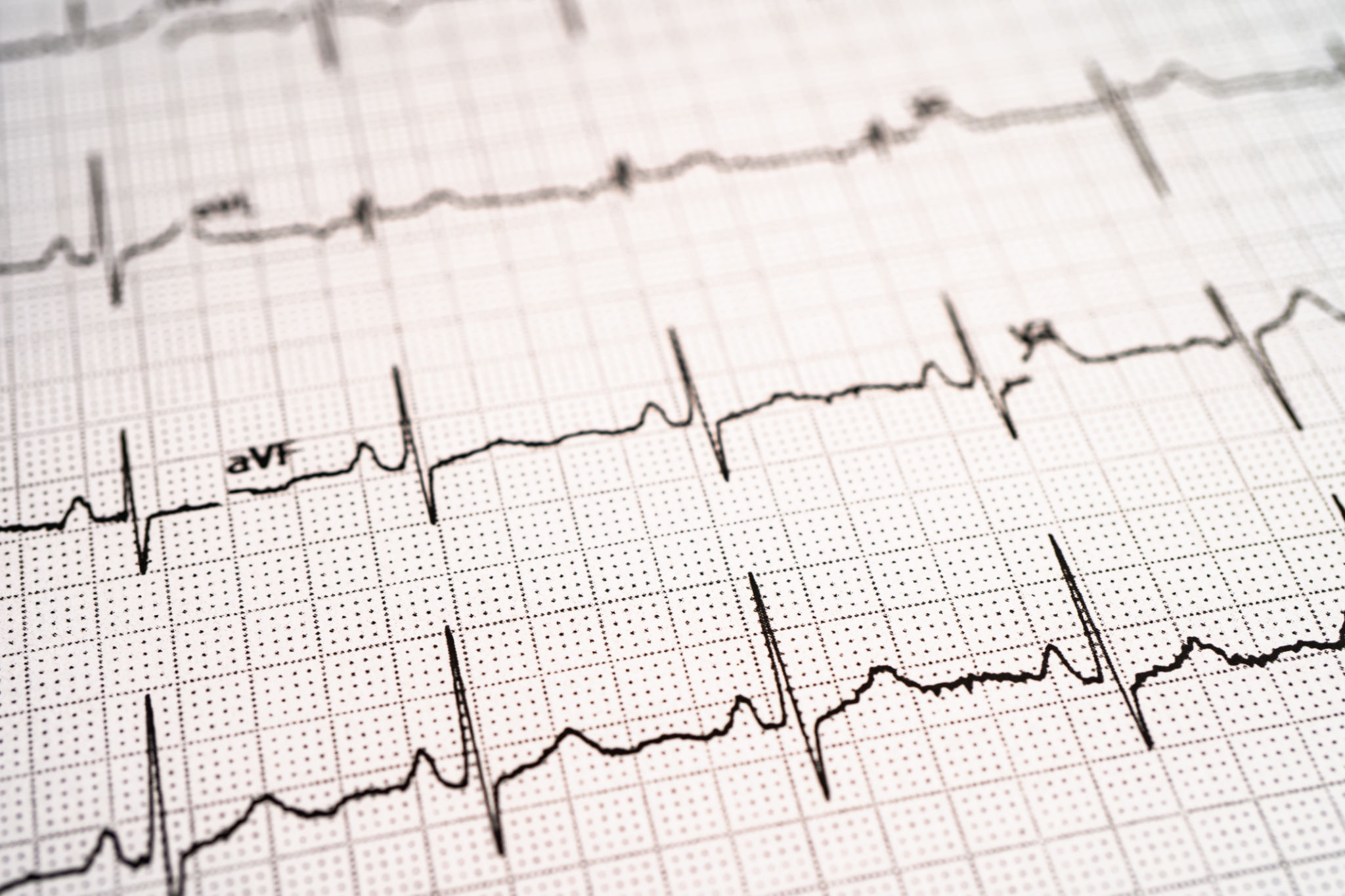 heart monitor