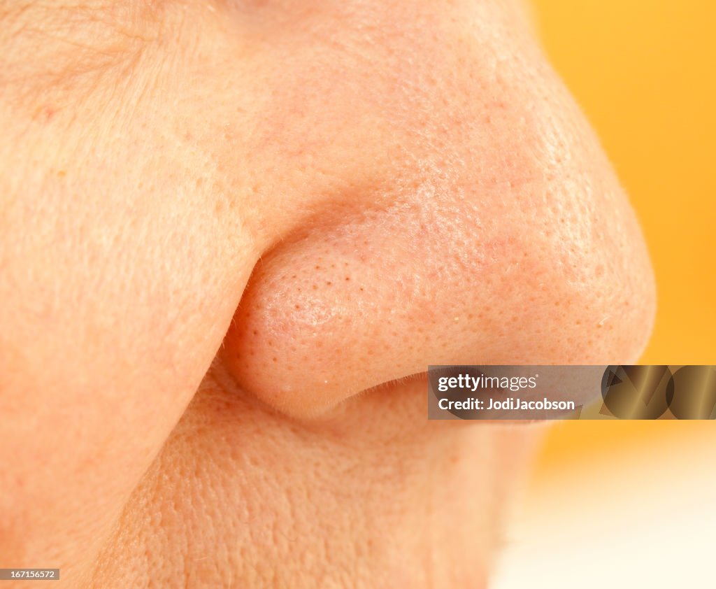 Clogged pores on nose