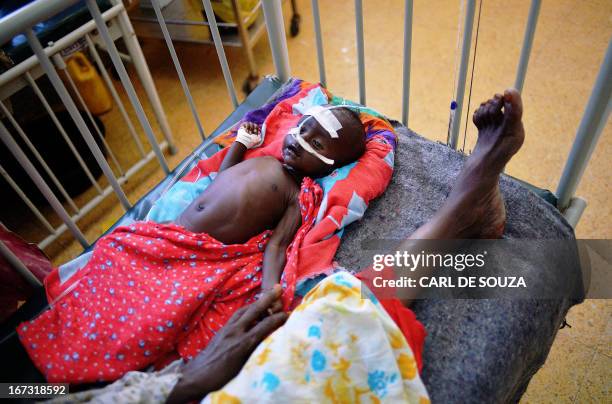 Malnourished Somali baby is pictured at Banadir hospital in Mogadishu on April 24, 2013. Somali children under one year of age will now receive the...