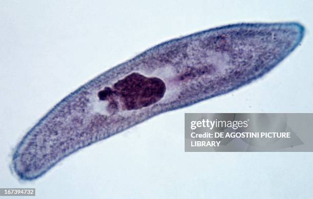 Paramecium viewed under a microscope, Protozoa.
