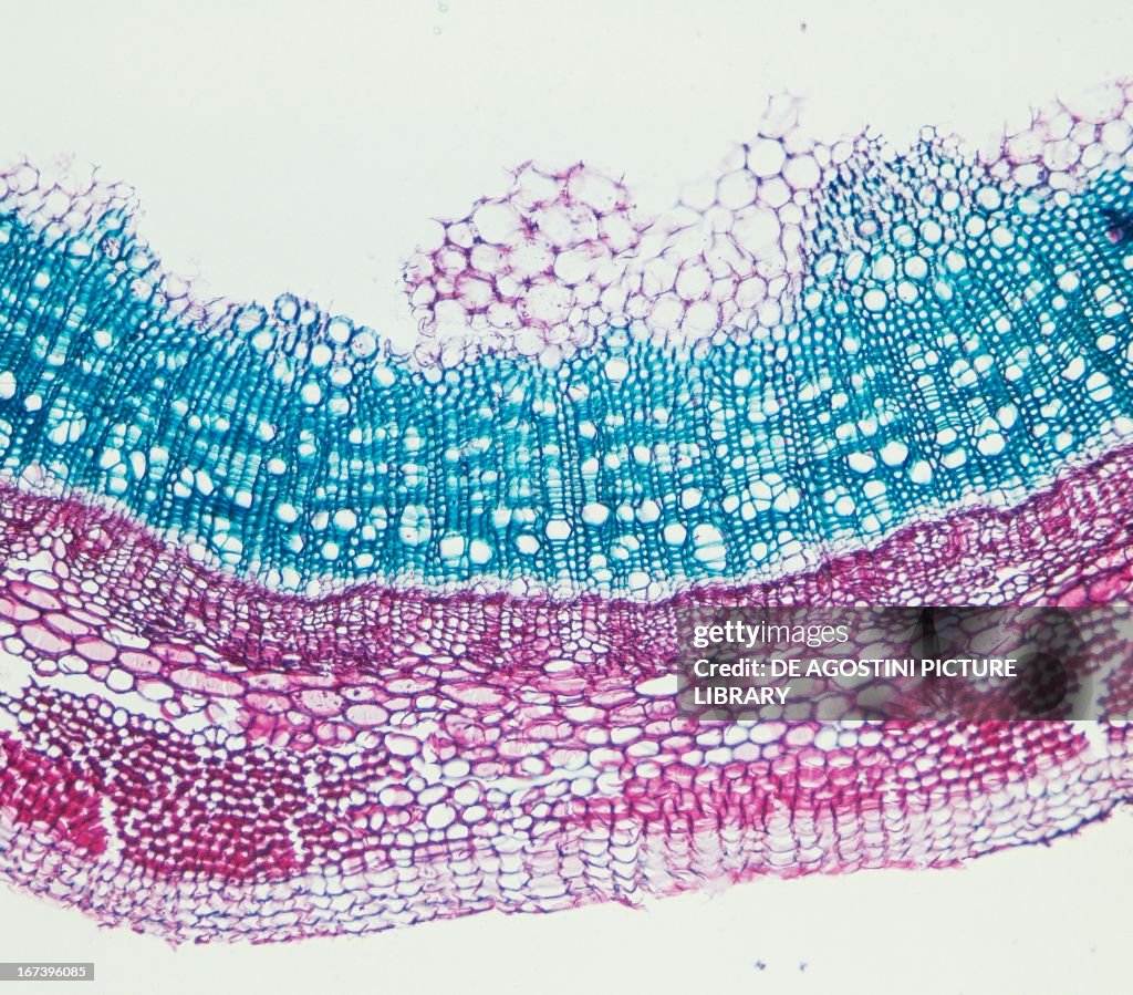 Cork, phellogen, felloderma and collenchyma